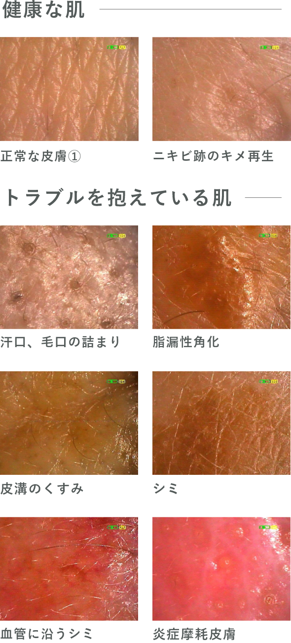 健康な肌とトラブルを抱えている肌の例